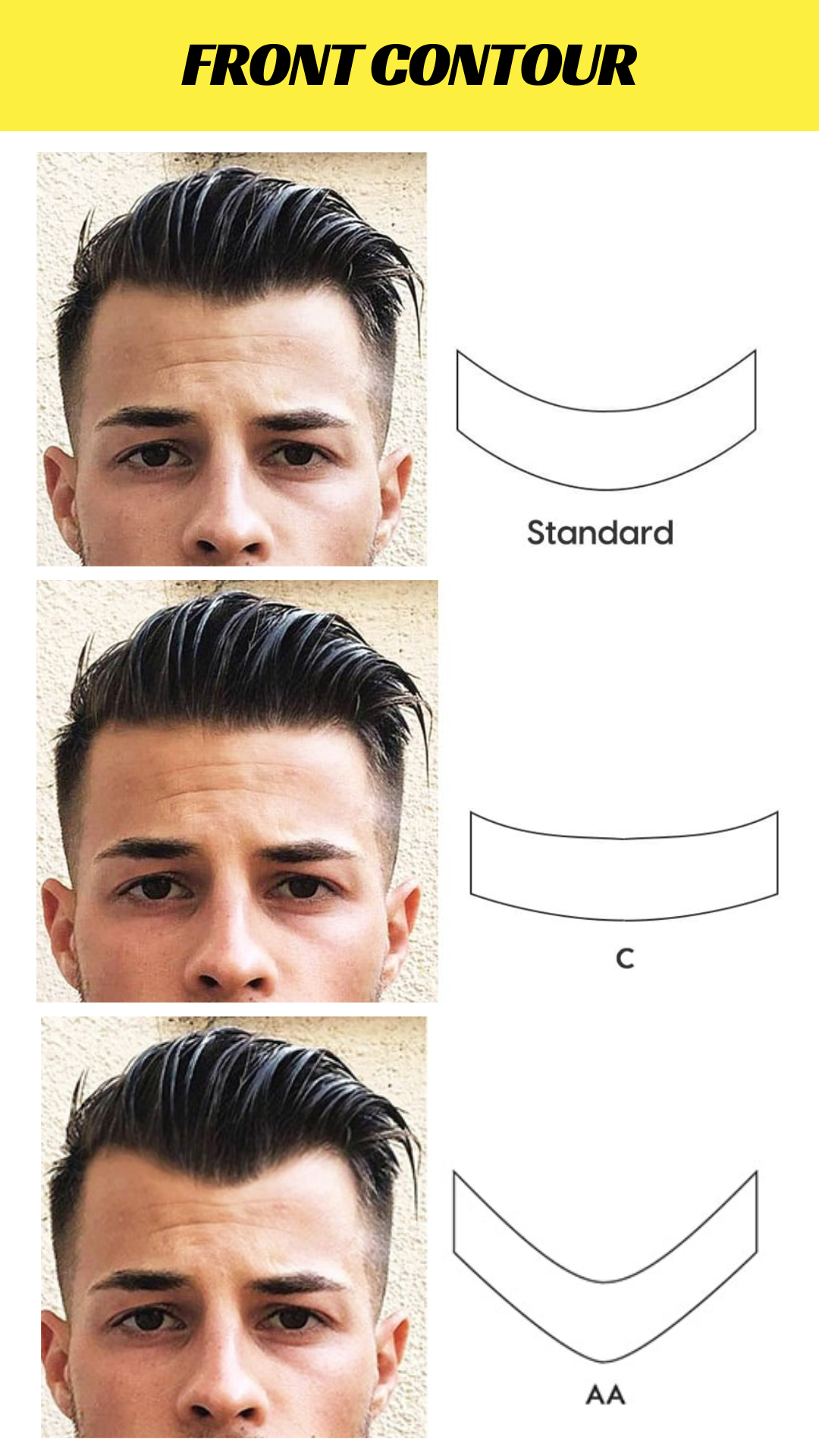 Personalized hair prosthesis base mix (Manufacture from scratch)